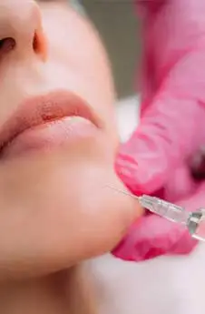 Hyaluronic Acid Chin/Jaw Filler