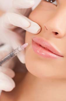 Hyaluronic Acid Fillers for Lips