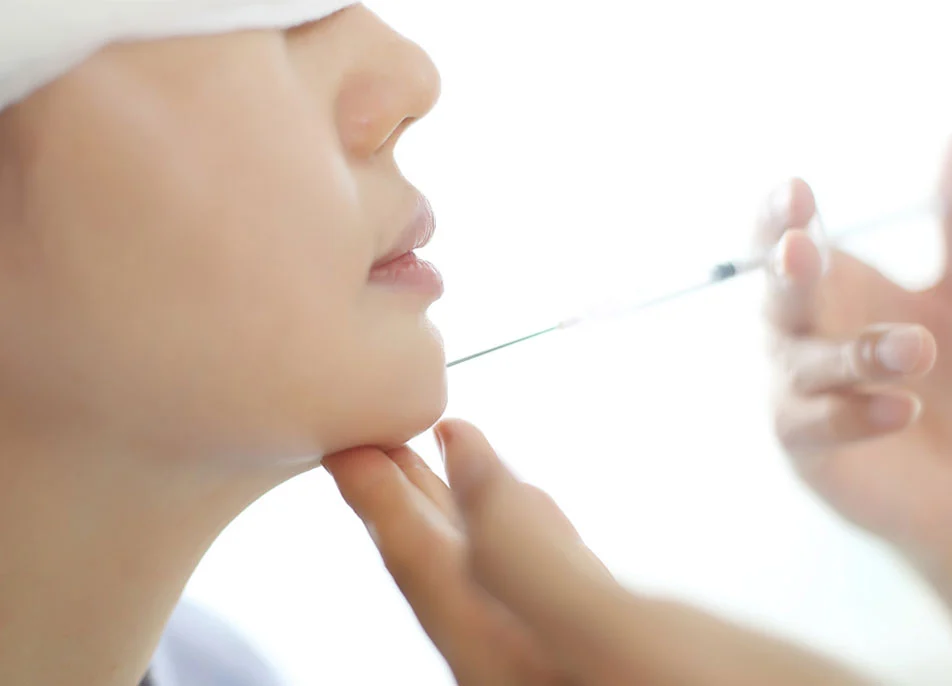 Hyaluronic Acid Chin/Jaw Filler